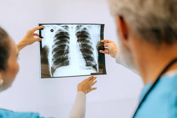 istock Doctors reviewing lung x ray together 2252536997