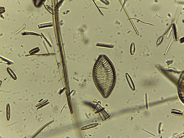 istock High Resolution Microscopic Study of Ornate Diatom Silica Frustules and Aquatic Microorgani 2252598404