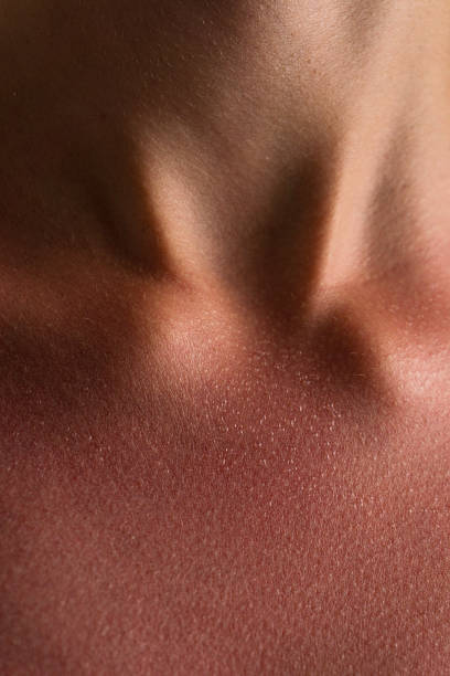istock Sunburned Skin Texture on Neck and Collarbone Close-Up 2252863986