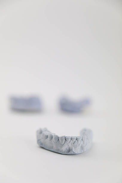 Dental Plaster Cast Of Human Teeth Standing On A White Background, Showing Detailed Jaw Anatomy And Orthodontic Impression Structure.
