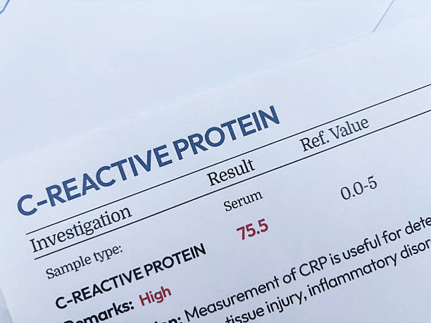 istock C-Reactive protein test report showing high value on the test top view backdrop. 2253303887