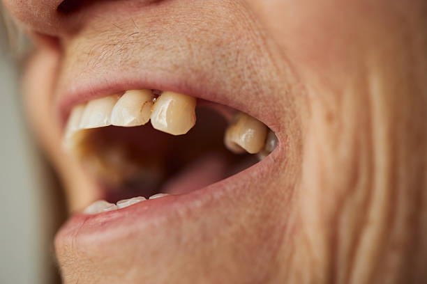 Close-up view of a child's mouth, revealing the simultaneous growth of permanent and baby teeth, highlighting the transition in dental development