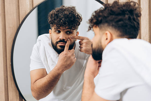istock Young handsome man with curly hair squeezing pimple in bathroom mirror 2253531152