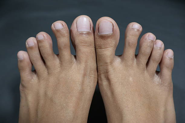 istock Comparison of Left and Right Human Feet Toes 2253692177