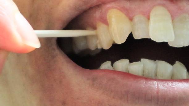 istock A person cleaning the gaps between their teeth with a toothpick 2253761964