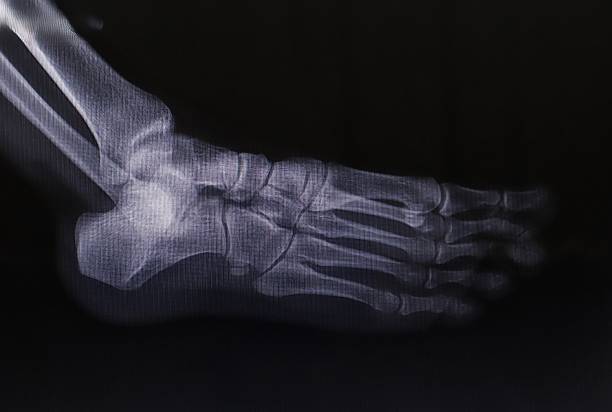 Radiologist examining and pointing at patient X-ray results and discussion with colleagues in hospital.