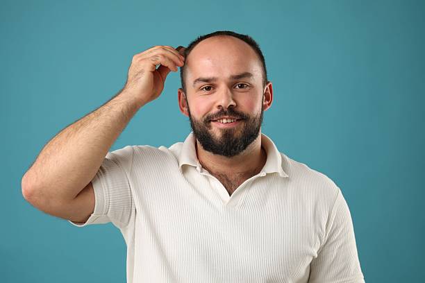 A bald man with a short beard wearing a yellow t-shirt poses against a plain white background. He presses his fists against his cheeks, showing a nervous and anxious expression. The image is perfect for illustrating concepts like stress, fear, and emotional tension.