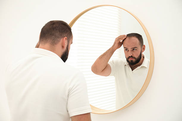 istock Baldness problem. Man with receding hairline near mirror at home 2254108030