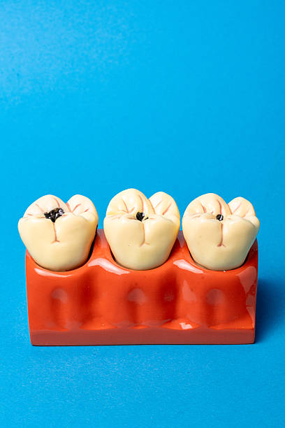 istock Dental health concept showing molar teeth cavities 2254729685