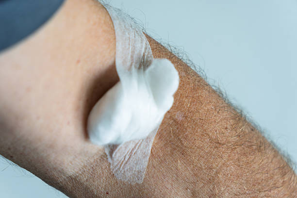 Closeup of Caucasian Man Damaged Broken Hand In Plaster and Bandaid Isolated on White Background. Horizontal image Composition