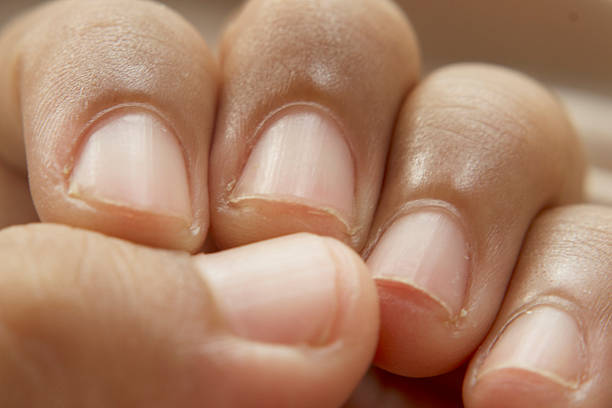 istock Unpolished Nails and Skin Texture in Realistic Grooming Scene 2255238062