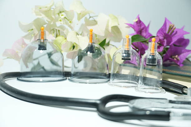 High Angle View Of Therapist Giving Cupping Therapy To Woman
