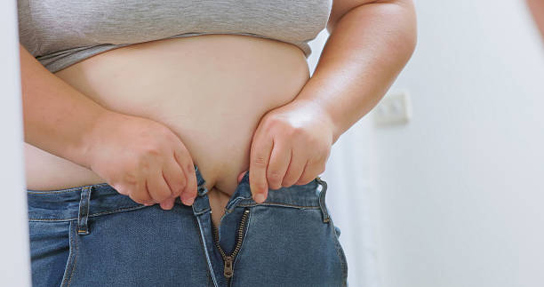 obese woman struggling to button her pants