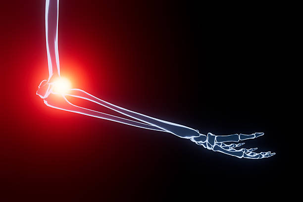 An arm is shown with a light outline against a dark background. The elbow joint has a red glow, indicating a focus on pain or injury in that area.