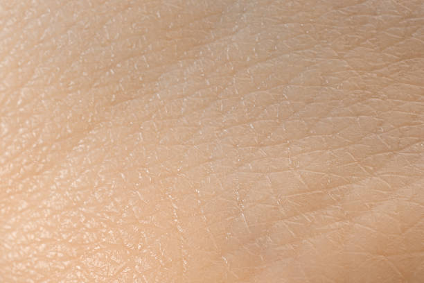 istock Texture of dry skin as background, macro view 2255915182
