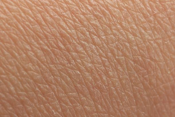 istock Texture of dry skin as background, macro view 2255915223