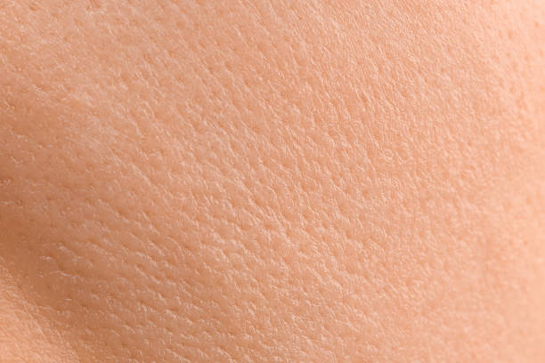 istock Texture of dry skin as background, macro view 2255917510