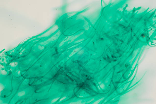 photo of green algae under the microscope