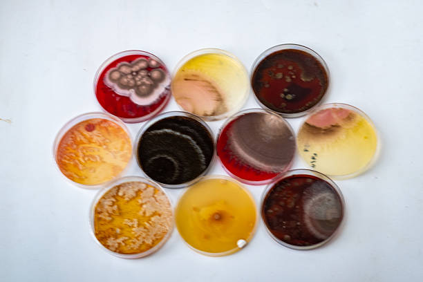 A collection of petri dishes containing various colorful bacterial cultures, showcasing different textures and patterns