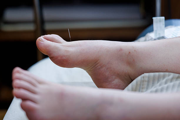 Close-up of badly cracked heel. Persons feet with dry skin. Barefoot adult with unattractive and unhealthy foot. Salon treatment and skin procedure needed concept