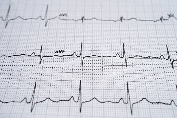 istock Electrocardiogram (ECG), heart wave, heart attack, cardiogram report. 2256696800