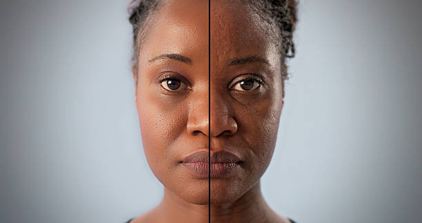 istock African Woman's Face Transformed Before And After 2257726803