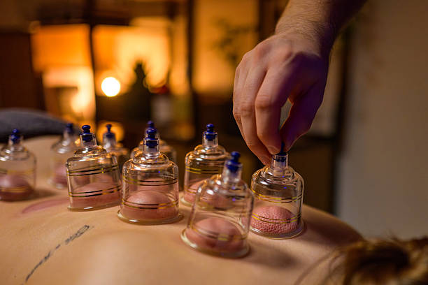 A person is undergoing traditional Chinese medicine cupping therapy