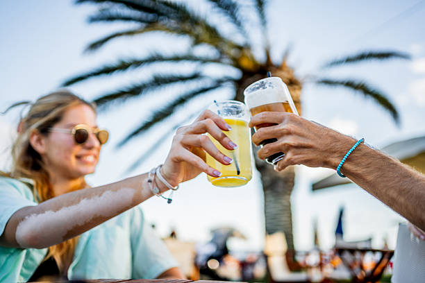 Young woman with vitiligo and partner toasting drinks at a sunny beach bar, celebrating vacation, inclusion and carefree summer fun