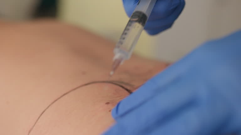 Buttock Injection 30+ Injection In Buttocks Female Stock Videos and Royalty-Free Footage ...
