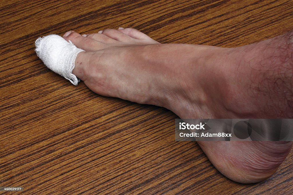 Bandage à l'avant-pied - Photo de Accident bénin libre de droits