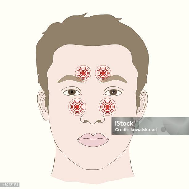 의학 일러스트 두통 질병 부비강 감염에 공격성에 대한 스톡 벡터 아트 및 기타 이미지 - 공격성, 부비동염, 건강관리와 의술