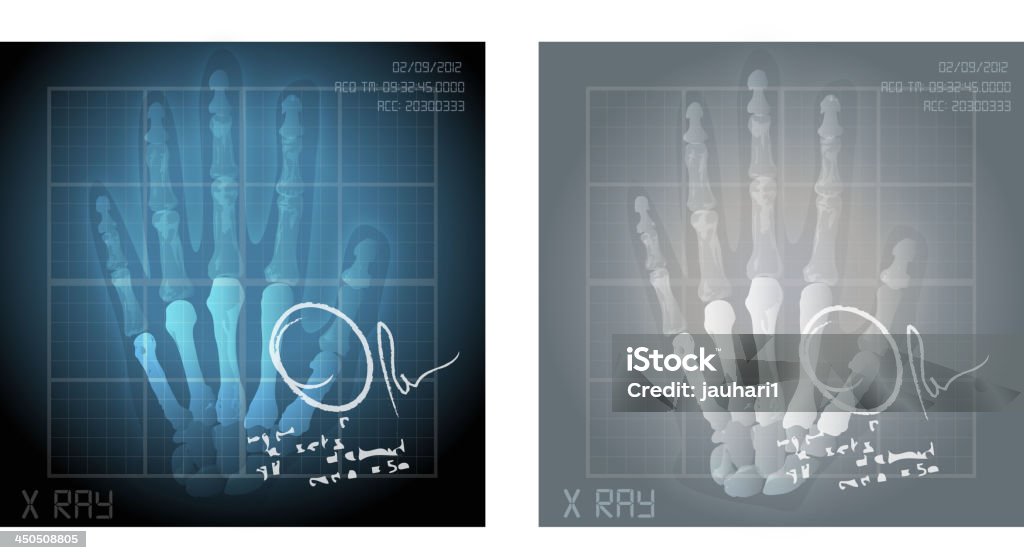 Hand X-Ray mit Arzt-Schein - Lizenzfrei Anatomie Vektorgrafik