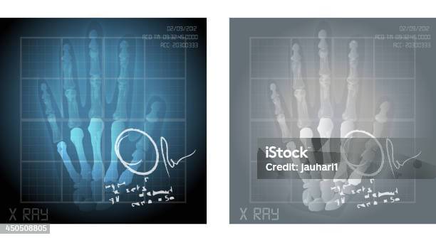 Hand Xray Mit Arztschein Stock Vektor Art und mehr Bilder von Anatomie - Anatomie, Biologie, Biomedizinische Illustration