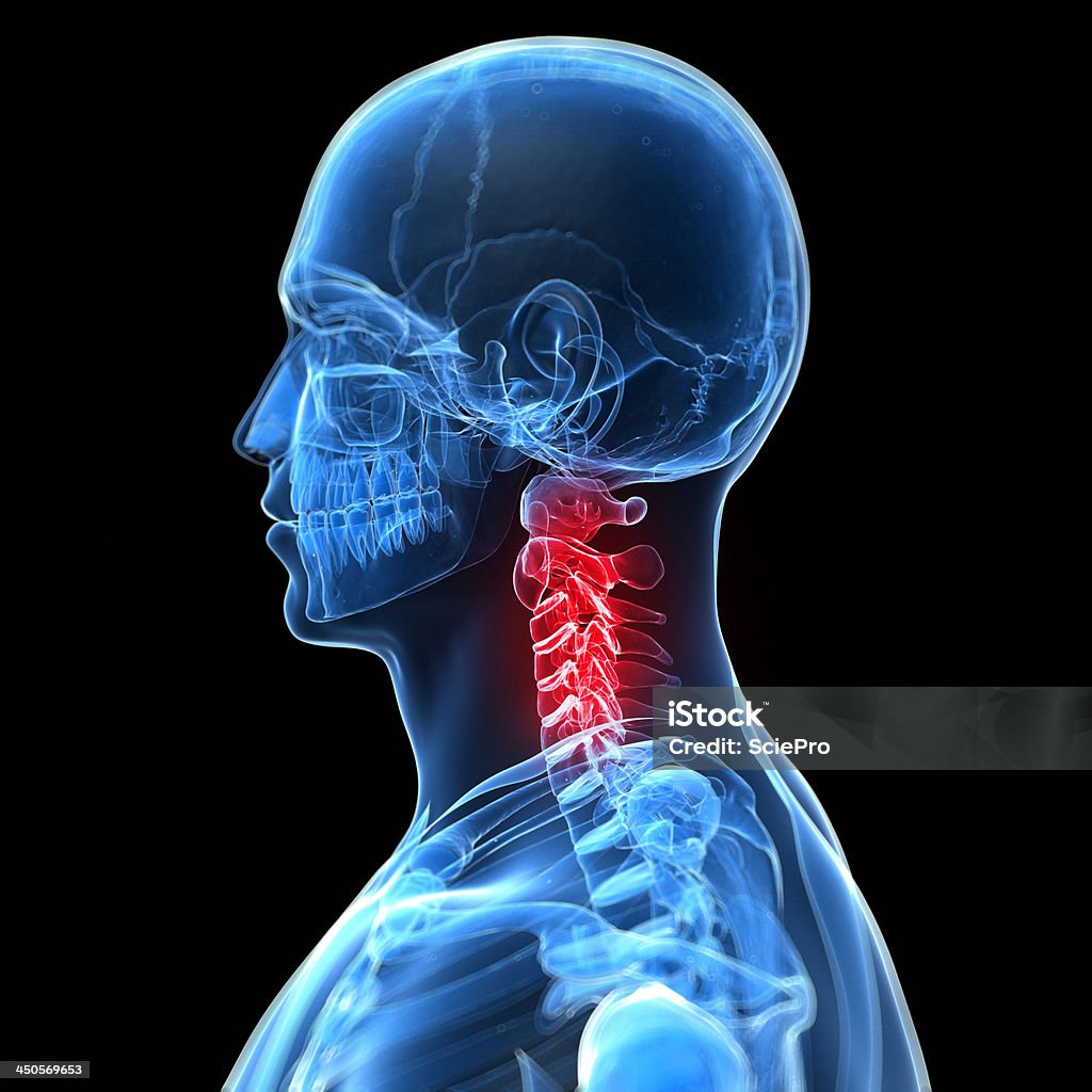 painful neck 3d rendered illustration of a painful neck Anatomy Stock Photo