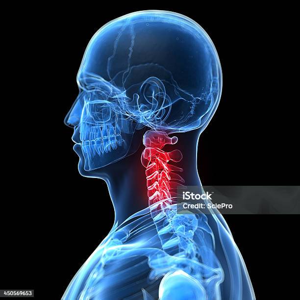 Painful Neck Stock Photo - Download Image Now - Anatomy, Backache, Biology