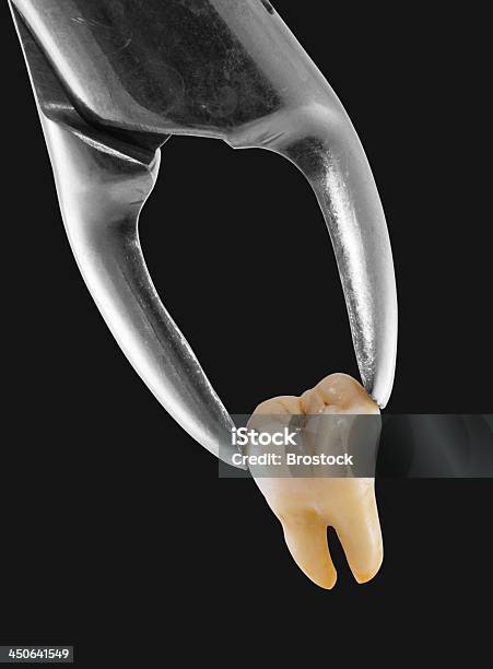Экстракция Зуба — стоковые фотографии и другие картинки Болезнь - Болезнь, Вертикальный, Здоровье зубов