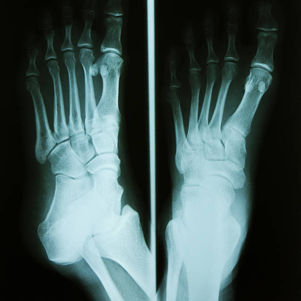 große x-ray. - bending human foot ankle x ray image stock-fotos und bilder