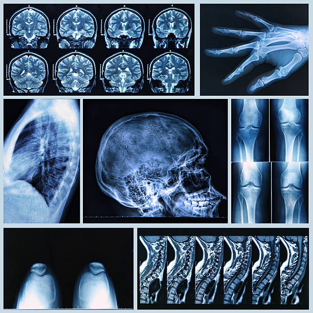 istock A collage of radiography showing human bones 450837375