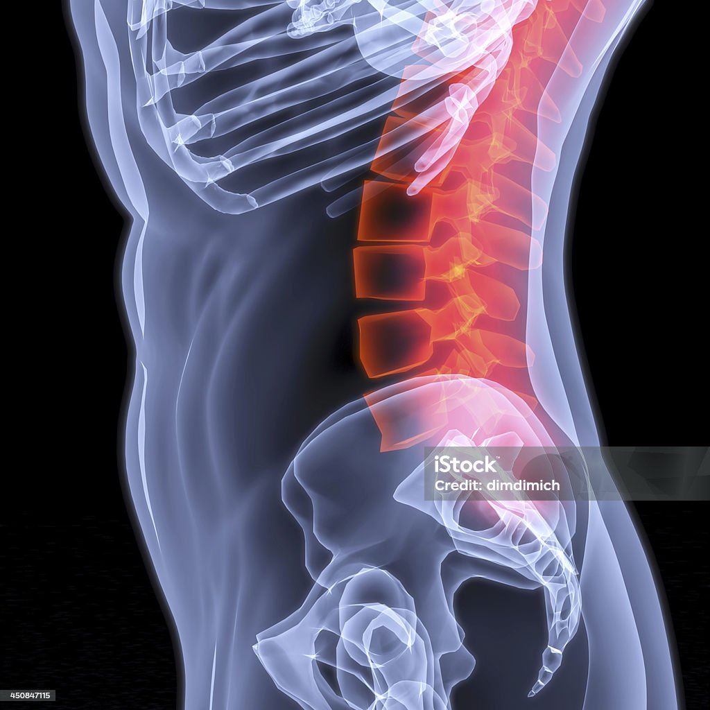 spine Male torso under X-rays. The spine is highlighted in red. Anatomy Stock Photo