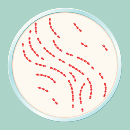 Petri Dish with Red Bacteria