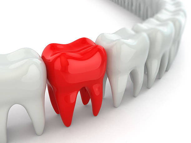 istock Aching tooth in row of healthy teeth. 451855605