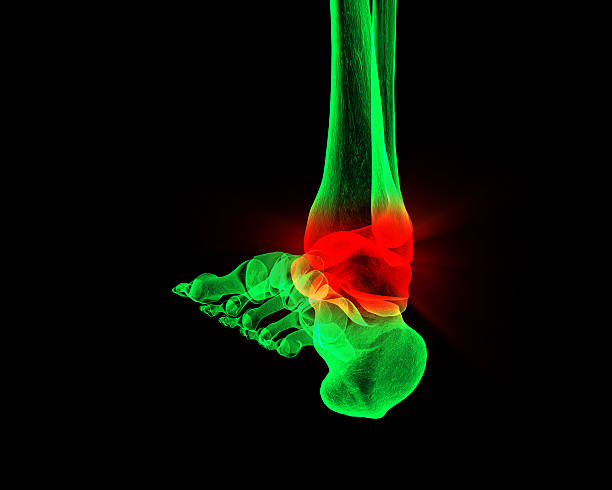 Sprained Ankle X-Ray stock photo