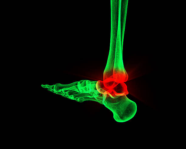 Ankle Injury X-Ray stock photo
