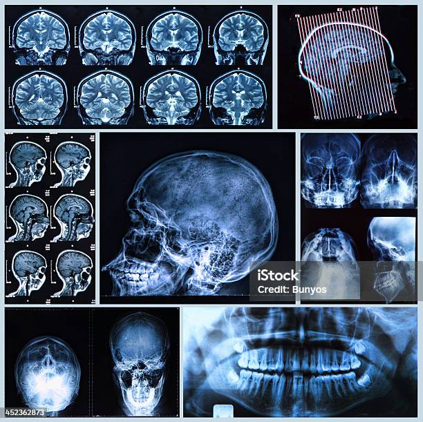 Photo libre de droit de Anatomie De La Tête Et Le Cou banque d'images et plus d'images libres de droit de Dos - Dos, Image par résonance magnétique, Imagerie par rayons x