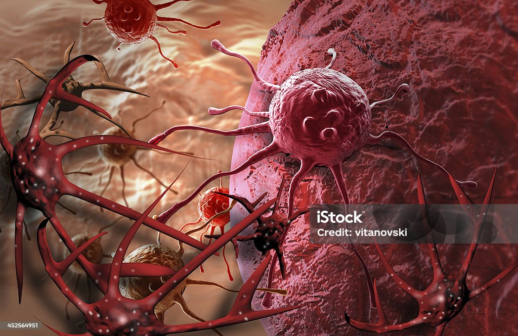 Cellule cancéreuse - Photo de Abdomen libre de droits