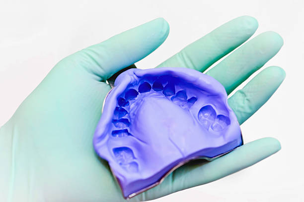 Dental Silicon Impression Dental silicon impression. Selective soft focus. dental impression tray stock pictures, royalty-free photos & images