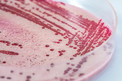 Listeria, bacteria in a petri dish, closeup