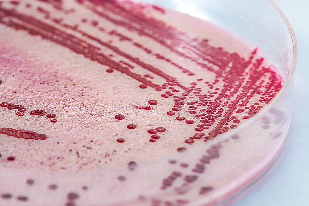 listeria - petri dish agar jelly laboratory glassware bacterium imagens e fotografias de stock