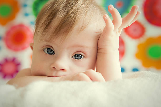 A cute baby girl posing for picture cheerful little baby girl with Downs Syndrome down syndrome stock pictures, royalty-free photos & images