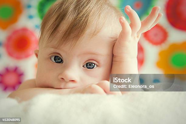 A Cute Baby Girl Posing For Picture Stock Photo - Download Image Now - Down Syndrome, Baby - Human Age, Child